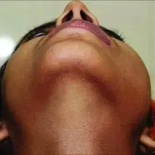 Underchin view, пример 3
